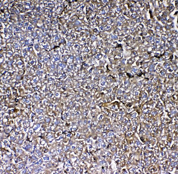 a01000 2 mbl2 primary antibodies ihc testing 2