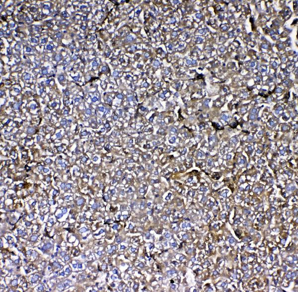 IHC analysis of MBL2 using anti-MBL2 antibody (A01000-2). MBL2 was detected in paraffin-embedded section of mouse liver tissue. Heat mediated antigen retrieval was performed in citrate buffer (pH6, epitope retrieval solution) for 20 mins. The tissue section was blocked with 10% goat serum. The tissue section was then incubated with 1μg/ml rabbit anti-MBL2 Antibody (A01000-2) overnight at 4°C. Biotinylated goat anti-rabbit IgG was used as secondary antibody and incubated for 30 minutes at 37°C. The tissue section was developed using Strepavidin-Biotin-Complex (SABC)(Catalog # SA1022) with DAB as the chromogen.