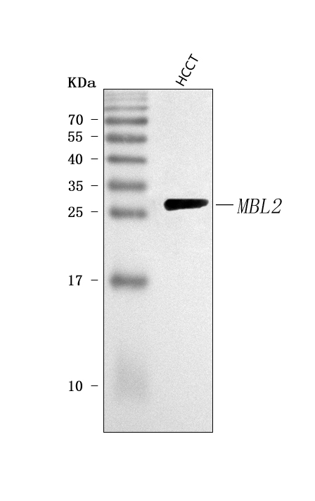  Western blot analysis of MBL2 using anti-MBL2 antibody (A01000-5)
