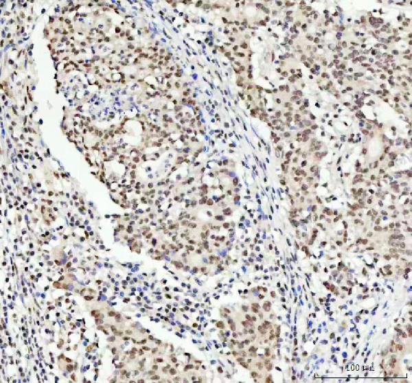  IHC analysis of TDP-43/TARDBP using anti-TDP-43/TARDBP antibody (A01001-3)