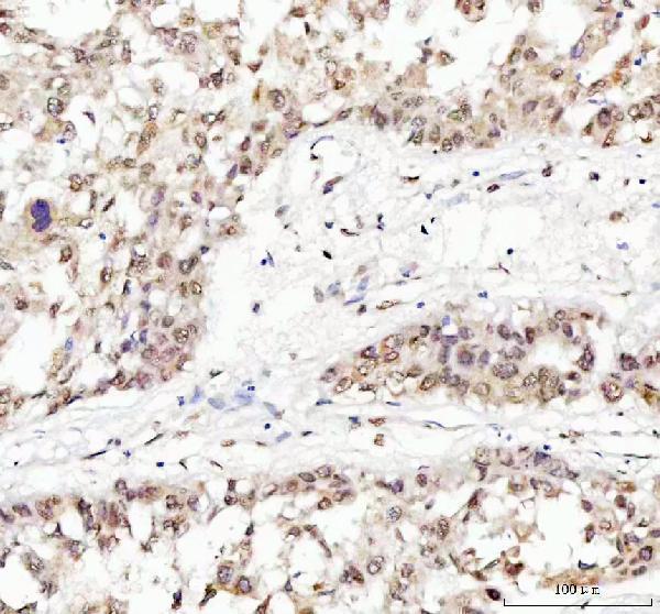  IHC analysis of TDP-43/TARDBP using anti-TDP-43/TARDBP antibody (A01001-3)