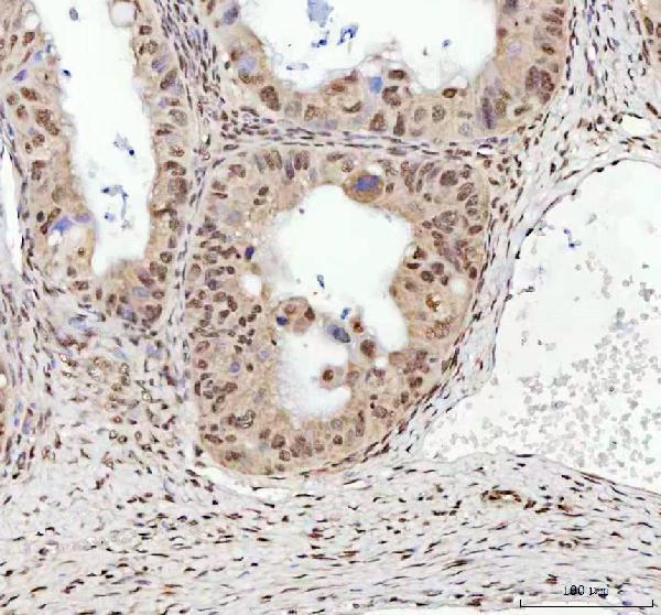 a01001 3 tardbp primary antibodies ihc testing 4