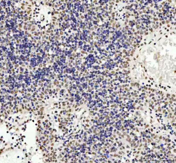 a01001 3 tardbp primary antibodies ihc testing 5