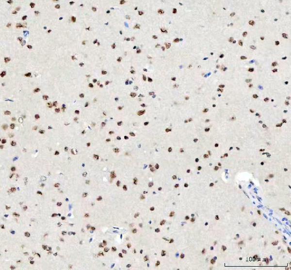 a01001 3 tardbp primary antibodies ihc testing 6