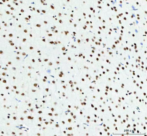 a01001 3 tardbp primary antibodies ihc testing 7