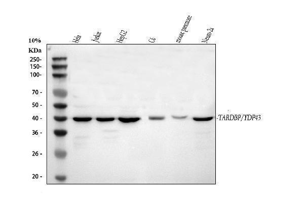  Western blot analysis of TDP-43/TARDBP using anti-TDP-43/TARDBP antibody (A01001-3)