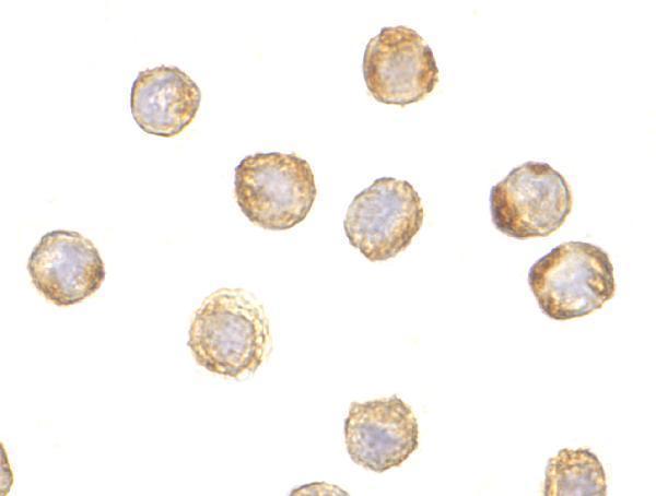 Immunocytochemistry of TDP43 in HeLa cells with TDP43 antibody at 5 μg/mL