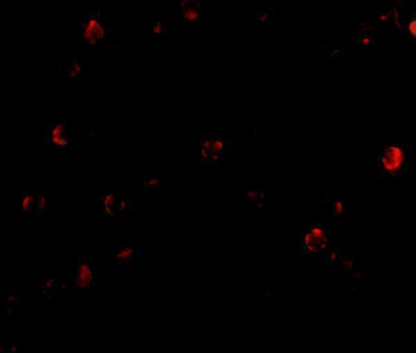 Immunofluorescence of TDP43 in Hela cells with TDP43 antibody at 20 μg/mL