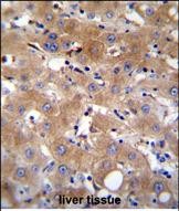 TRPM8 Antibody (Center) (Cat