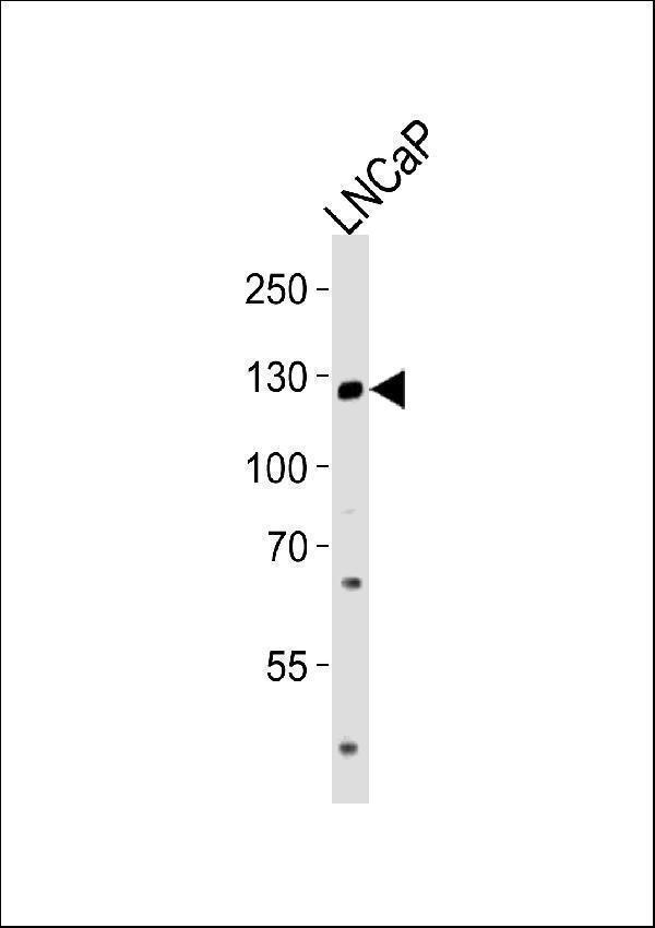 Western blot analysis of lysate from LNCaP cell line,using TRPM8 Antibody (Center) (Cat