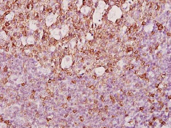 a01004 mok primary antiboties ihc testing 2