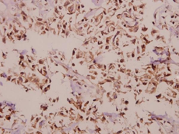 a01007 2 cbfb primary antiboties ihc testing 2