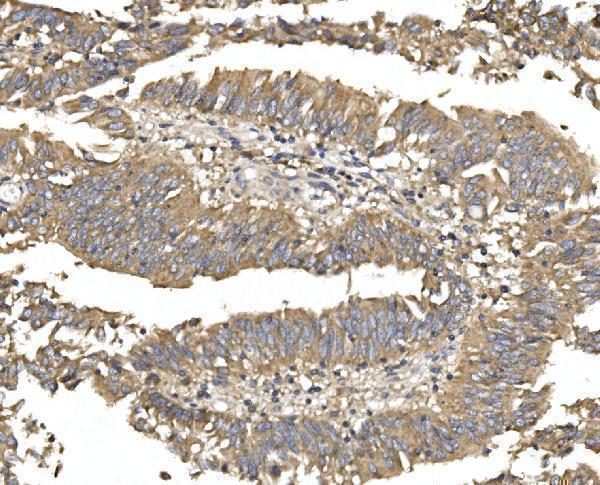  IHC analysis of Alkaline phosphatase/ALPL using anti-Alkaline phosphatase/ALPL antibody (A01008-1)