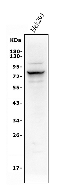  Western blot analysis of Alkaline phosphatase/ALPL using anti-Alkaline phosphatase/ALPL antibody (A01008-1)