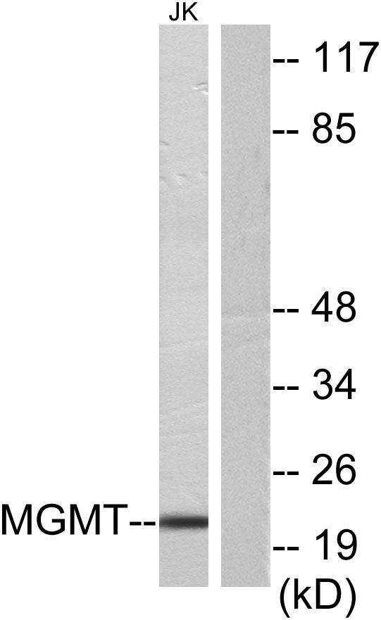 Western blot analysis of lysates from Jurkat cells, using MGMT Antibody