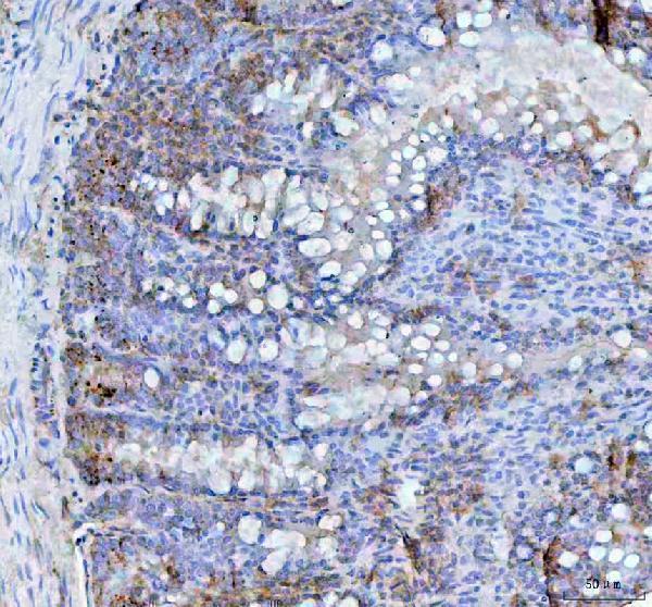 a01014 2 bcma primary antibodies ihc testing 2