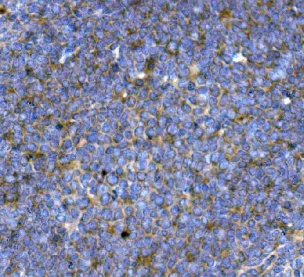a01014 4 tnfrsf17 primary antibodies ihc testing 4