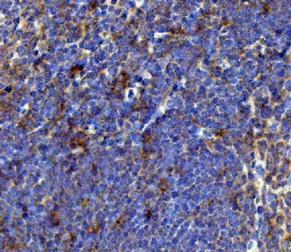 a01014 4 tnfrsf17 primary antibodies ihc testing 5