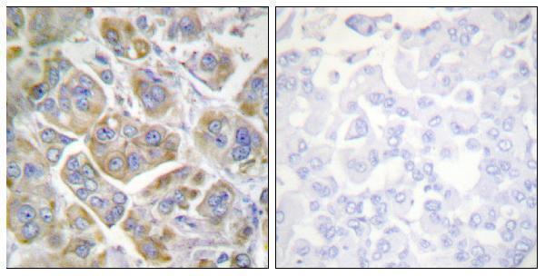 a01015 1 itgb4 primary antibodies ihc testing 1