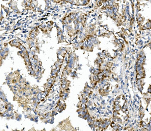 a01015 2 itgb4 primary antibodies ihc testing 2
