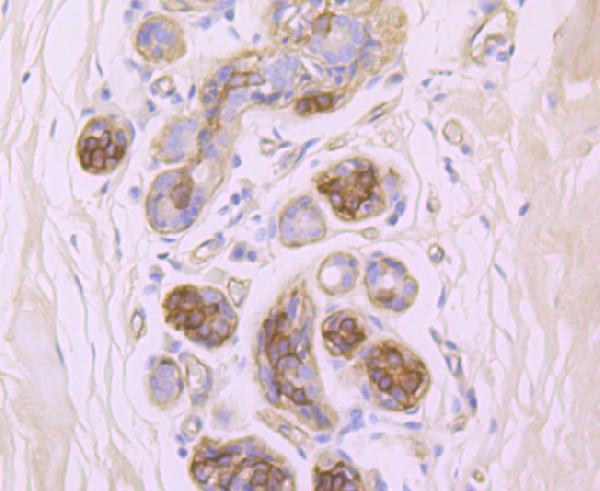 a01015 itgb4 primary antiboties ihc testing 2