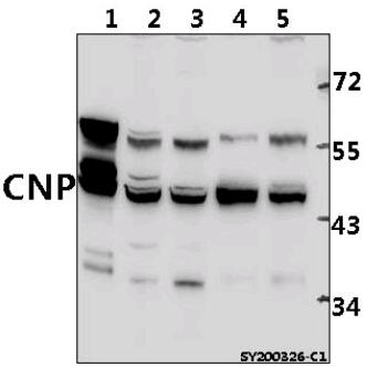 Western blot (WB) analysis of CNP pAb at 1:1000 dilution
Lane1:The Brain tissue lysate of Mouse(40ug)
Lane2:PC12 whole cell lysate(40ug)
Lane3:CT-26 whole cell lysate(40ug)
Lane4:SGC7901 whole cell lysate(40ug)
Lane5:K562 whole cell lysate(40ug)