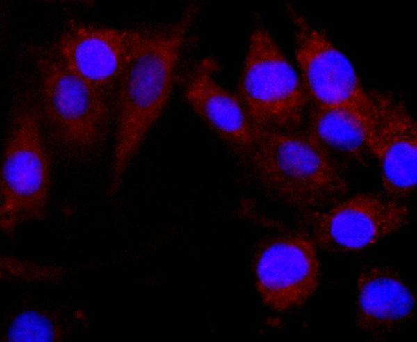 ICC staining CNPase in SHG-44 cells (green)