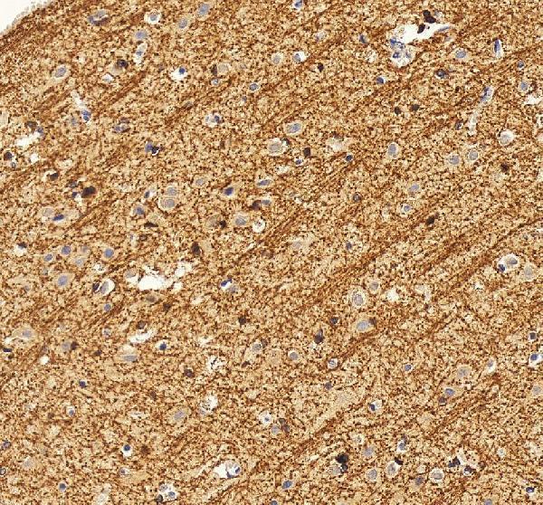 IHC analysis of CNPase/CNP using anti-CNPase/CNP antibody (A01017-4)