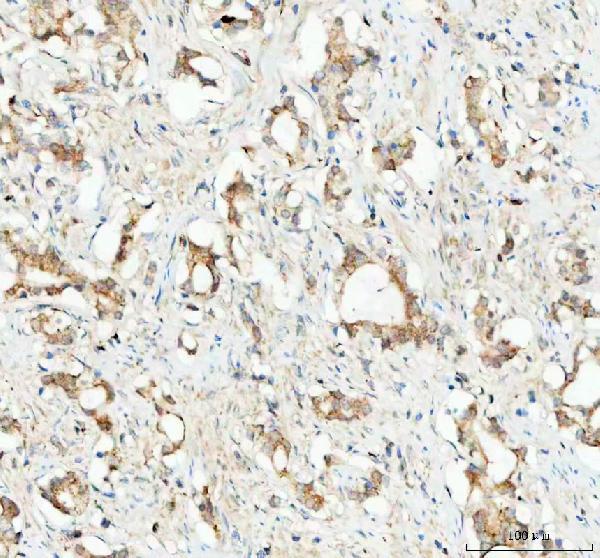  IHC analysis of GPX1 using anti-GPX1 antibody (A01019-2)