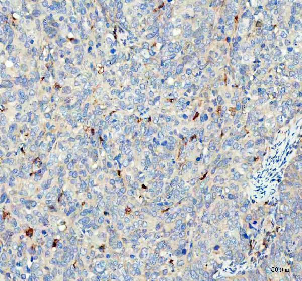  IHC analysis of GPX1 using anti-GPX1 antibody (A01019-2)