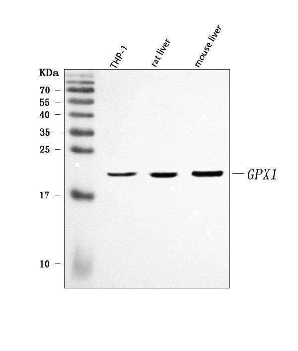  Western blot analysis of GPX1 using anti-GPX1 antibody (A01019-2)
