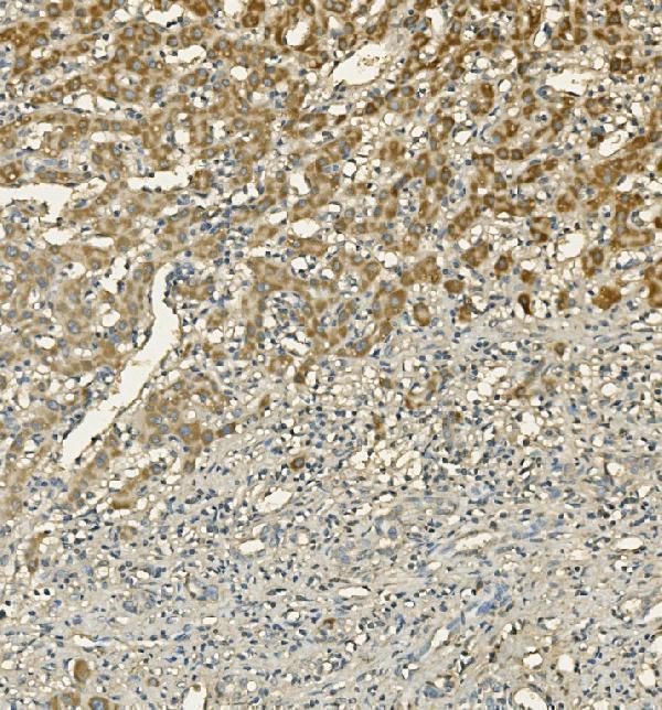  IHC analysis of LIPC using anti-LIPC antibody (A01020-1)