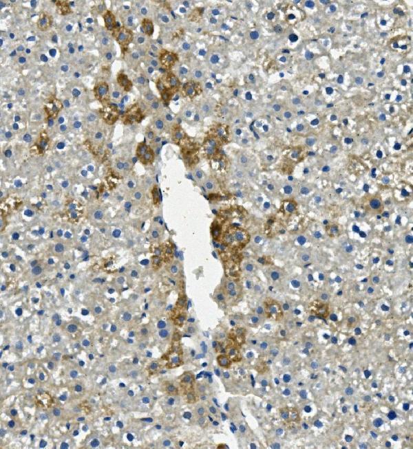 IHC analysis of LIPC using anti-LIPC antibody (A01020-1)