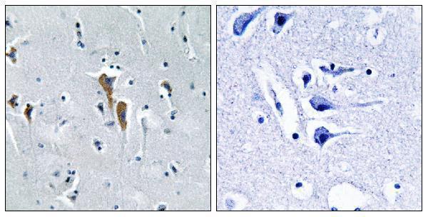 a01020 2 lipc primary antibodies ihc testing 1