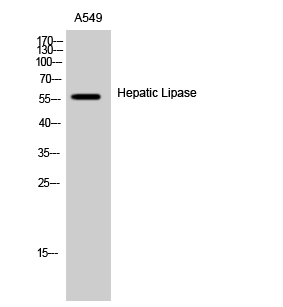 Western Blot analysis of A549 cells using Hepatic Lipase Polyclonal Antibody