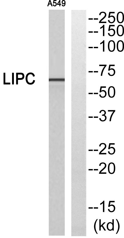 Western blot analysis of LIPC Antibody
