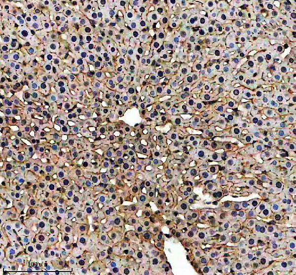 IHC analysis of LIPC using anti-LIPC antibody (A01020-3)