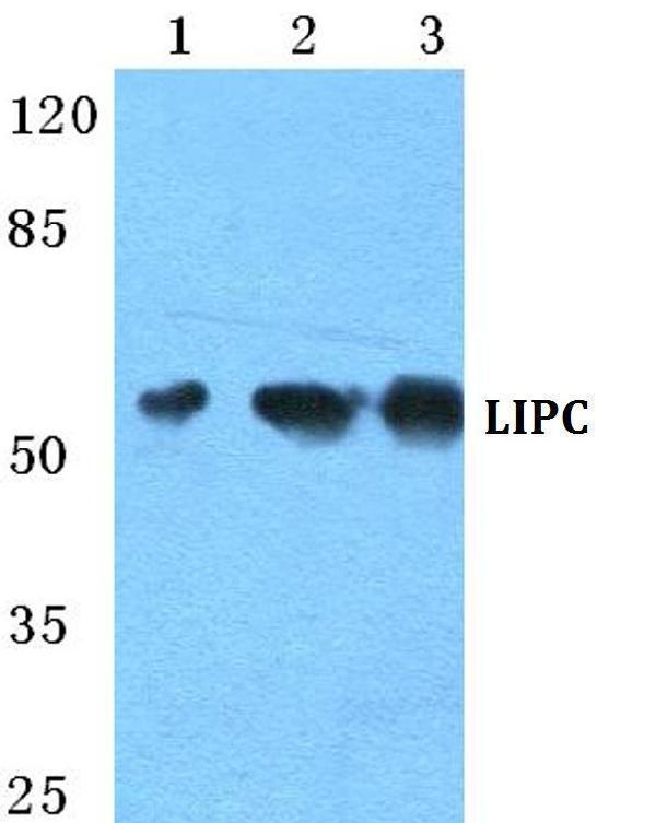 Western blot (WB) analysis of LIPC polyclonal antibody at 1:500 dilution
Lane1:HEK293T cell lysate
Lane2:NIH-3T3 cell lysate
Lane3:H9C2 cell lysate