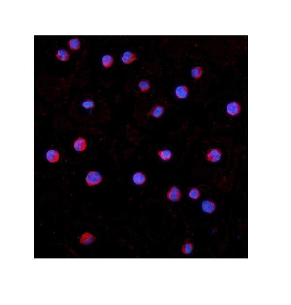a01021 1 irak1 primary antibodies if testing 4