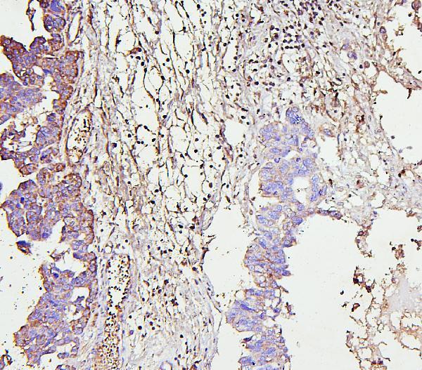  IHC analysis of IRAK1 using anti-IRAK1 antibody (A01021-1)