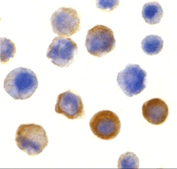 a01021 2 irak1 primary antibodies icc testing 6