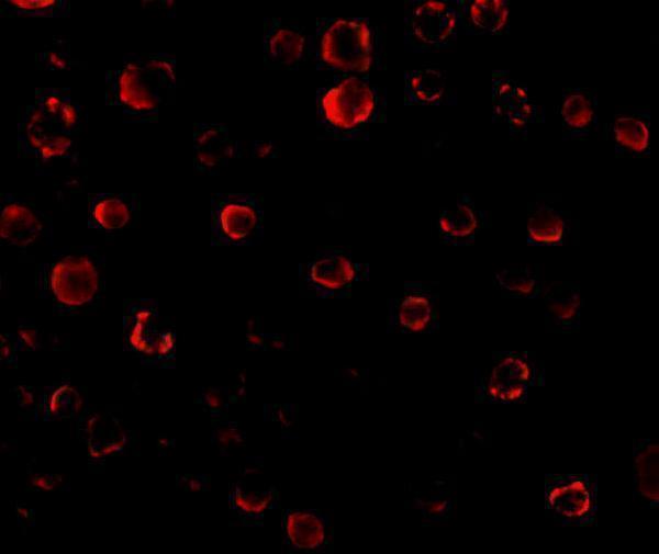 a01021 2 irak1 primary antibodies if testing 5