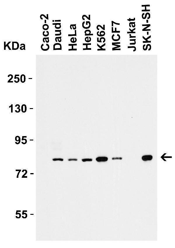 Western Blot Validation in Human Cell Lines
Loading: 15 μg of lysates per lane