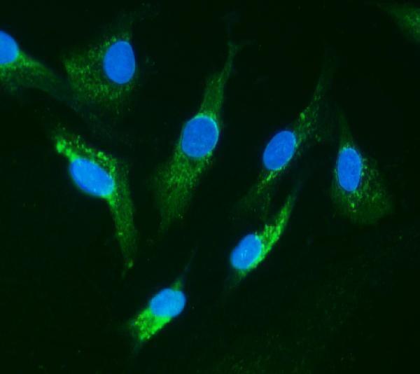a01021 irak primary antibodies if testing 2