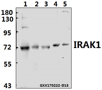 Western blot (WB) analysis of IRAK1 (T381) polyclonal antibody at 1:500 dilution
Lane1:L02 whole cell lysate(40ug)
Lane2:THP-1 whole cell lysate(40ug)
Lane3:HCT116 whole cell lysate(40ug)
Lane4:PC12 whole cell lysate(40ug)
Lane5:CT26 whole cell lysate(40ug)