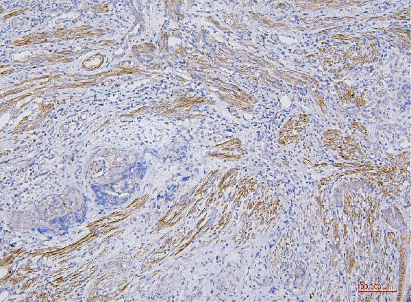 a01022 1 cd35 primary antibodies ihc testing 2