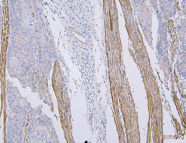 a01022 1 cd35 primary antibodies ihc testing 3