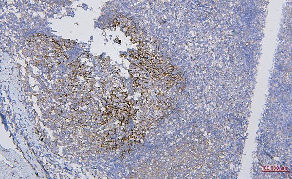 a01022 1 cd35 primary antibodies ihc testing 4