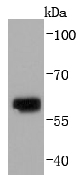 Western blot analysis of Collagen X on human skin lysates using anti-Collagen X antibody at 1/1,000 dilution
