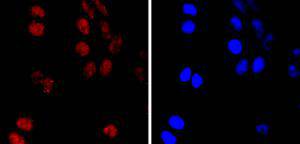 ICC staining PMS2 in Hela cells (red)